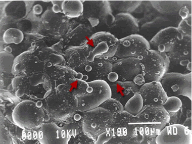 laser dissolve