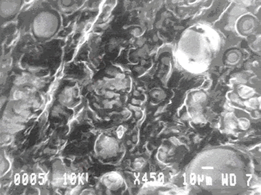 laser dissolve