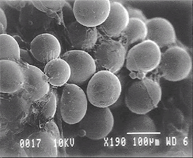 laser dissolve